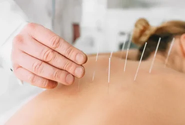 What Is Acupuncture and How Can It Improve Your Health?