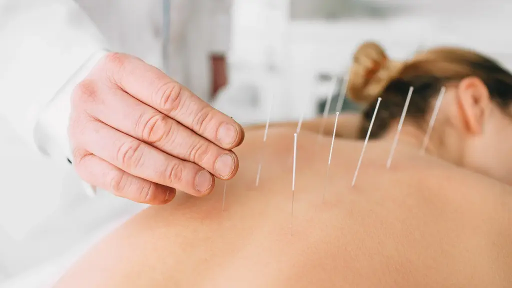 What Is Acupuncture and How Can It Improve Your Health?